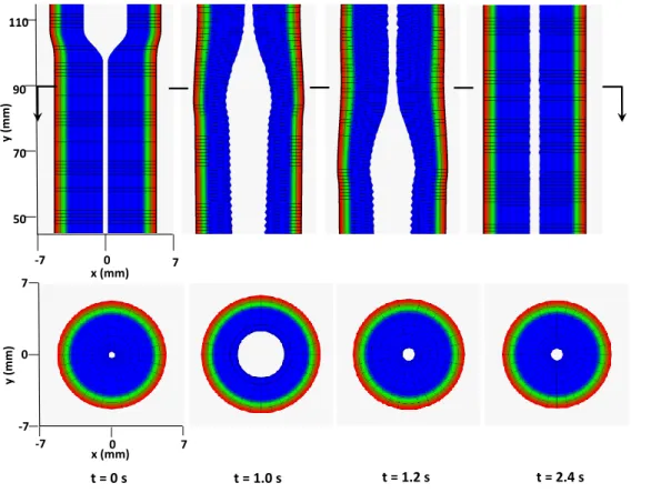Fig. 11. Kinematics of the esophageal layers at four different stages: at rest (t = 0 s); at dilation (t = 1.0 s); at contraction (t = 1.2 s); and at relaxation (t = 2.4 s) for Case 2 in Section 4.4.2