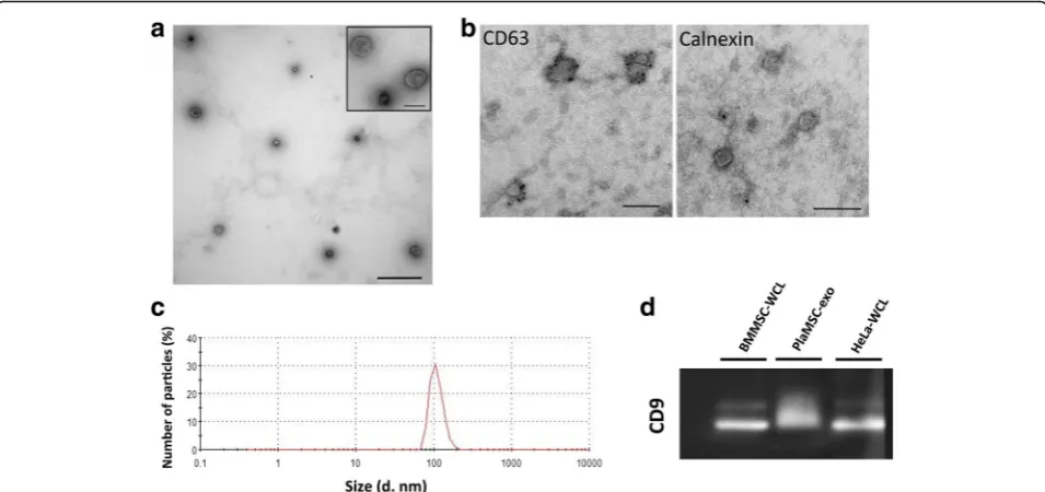 Fig. 3 PlaMSC-derived exosomes.of the exosome marker CD9. BMMSC-WCL and HeLa-WCL used as controls