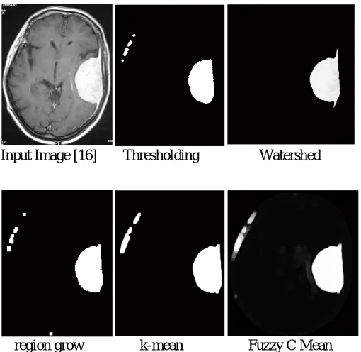 FIGURE 4. Comparison of all the segmentation methods implemented [7] 