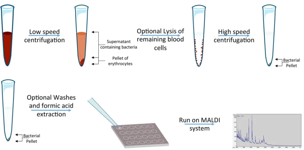 FIG 1 Procedures between studies to perform identiﬁcation directly from positive blood cultures using MALDI-TOF MS can differ greatly but usuallyfollow a similar workﬂow