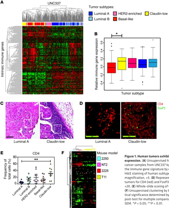 Figure 1. Human tumors exhibit differential immune gene  expression. (A) Unsupervised hierarchical clustering of breast  cancer samples from UNC337 by IIG list