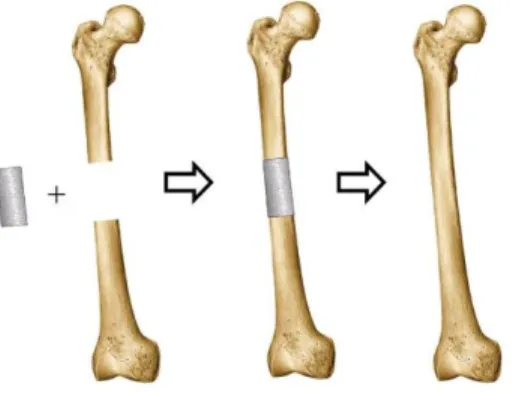 Figure 1.3. Bone tissue engineering concept. (Reprinted from https://goo.gl/images/CtzKJF