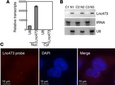 Figure 5. LINC00473 shows predominantly nuclear localization with dis- dis-tinct nuclear structures