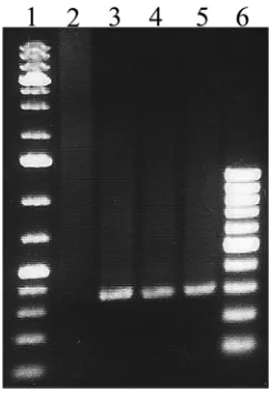 FIG 6 A lectin dot blot assay was performed for GBS isolates that failed to be assigned a CPS type by theimmunodiffusion assay (NT isolates)