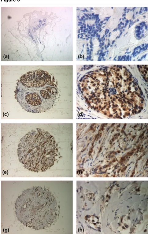 Figure 5oesophageal cancer [26,27]. Bani and colleagues [26] ana-lysed mice with human ovarian carcinoma xenografts undergo-