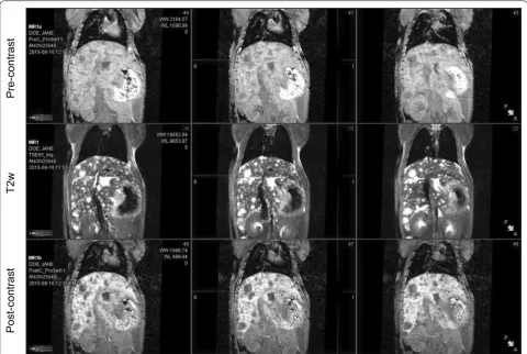 Fig. 1 Comparison of MRI imaging of BL0293-F563 liver metastases. MRI images from a representative mouse with known BL0293-F563 metastatic disease to the liver comparing T1w non/pre-contrast images (top row), T2w non-contrast images (middle row) and T1w po