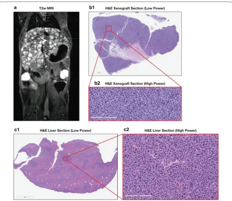 Table 1 T2w MRI metastases scoring system for BL0293