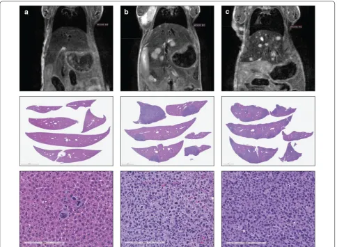 Fig. 6 MRI image and histology correlations. Shown here are the MRI, low-power tissue image and high-power H&E images from a mouse with low (a), moderate (b) and severe (c) metastatic burden in the liver