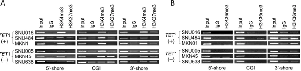 Figure 6: Histone modifications at TET1 genomic loci in GC cell lines. A. , B. ChIP-PCR to detect histone modifications in the CGI 5′-shore, CGI, and 3′-shore regions of TET1