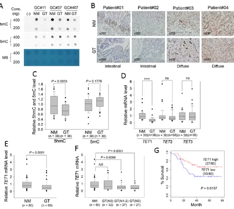 Figure 1: Measurement of global 5hmC and 5mC and expression of TET family genes in primary GTs