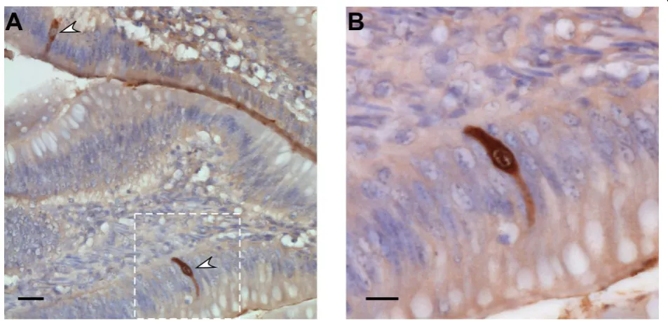 Figure 2 Subcellular localization of NS1 in duck ileal epithelial cellsperoxidase-coupled secondary antibody revealed with diaminobenzidine, hematoxylin counterstained