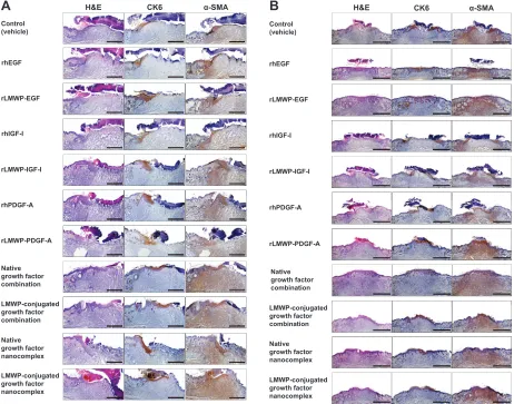 Figure 7 The LMWP-conjugated growth factor nanocomplex gel formulation accelerated wound re-epithelialization and granulation tissue formation within 9 days.Notes: Wound sections stained with H&E for observation of re-epithelialization; immunohistochemical