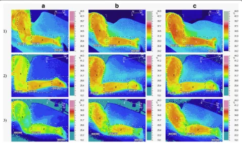 Figure 1 Temperature reaction measured on skin surface (short-term vasodilation effect)