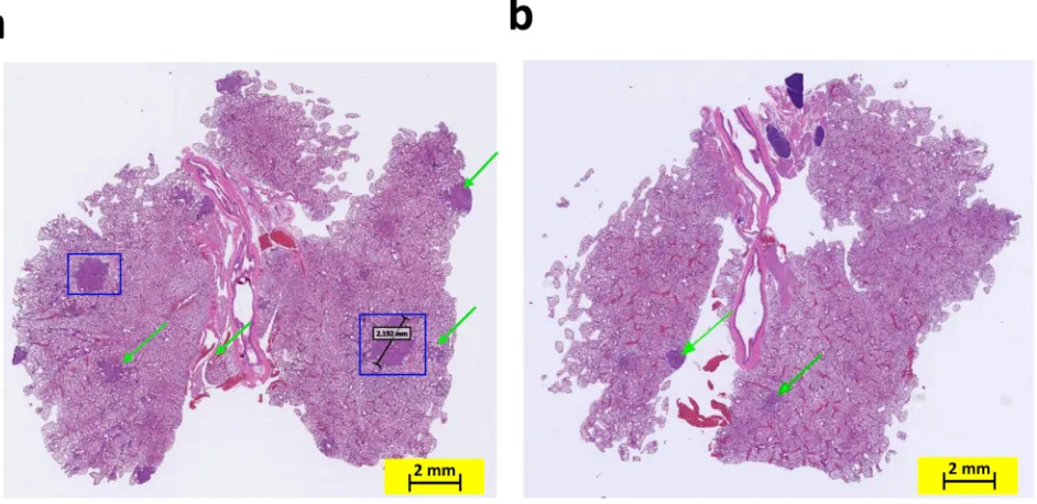 Figure 2: Knocking out the COX-2 gene in K-ras mice inhibited the formation of adenocarcinoma in the lungs by age 4 months