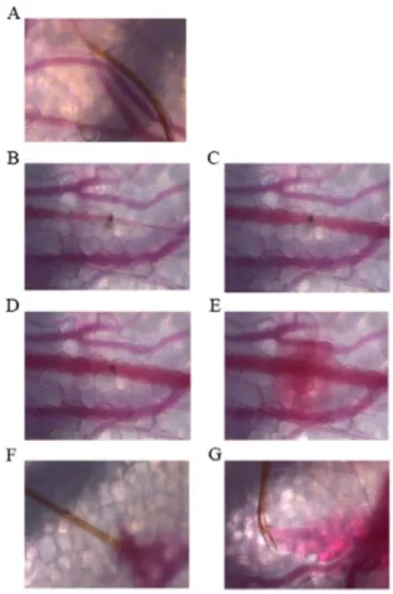Figure 1.2. Skin micrographs showing mosquito-feeding patterns.  