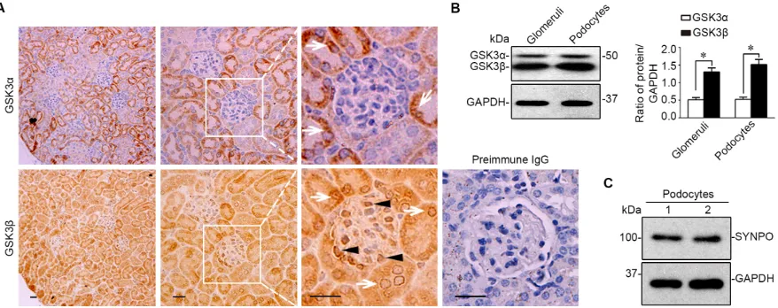 Figure 1: The β instead of the α isoform of GSK3 is predominantly expressed in glomeruli and mainly located to podocytes in mouse kidneys