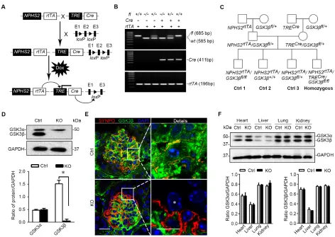 Figure 2: Mice with podocyte specific deletion of GSK3β are generated by the doxycycline inducible Cre/loxP mediated gene targeting system
