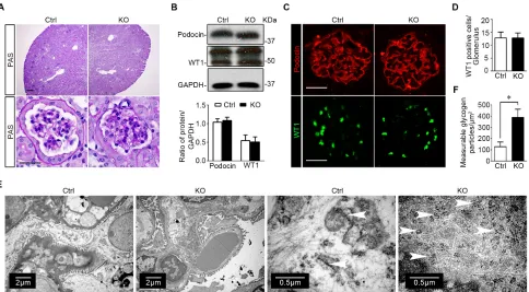 Figure 5: Specific ablation of GSK3β in mature glomerular podocytes does not affect kidney histology except an increase of glycogen accumulation in podocytes