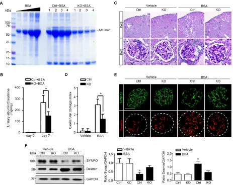 Figure 6: Podocyte specific knockout of GSK3β attenuates proteinuria and ameliorates oxidative glomerular injury in protein overloaded mice