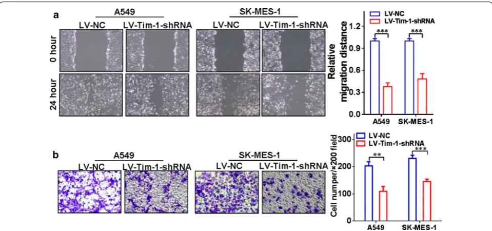 Fig. 6 Depletion of TIM-1 affects cellular functions of NSCLC cells. a The cell-free area of the LV-TIM-1-shRNA group was significantly narrower than that of the LV-NC group at 24 h (both P < 0.001 in A549 and SK-MES-1 cells)