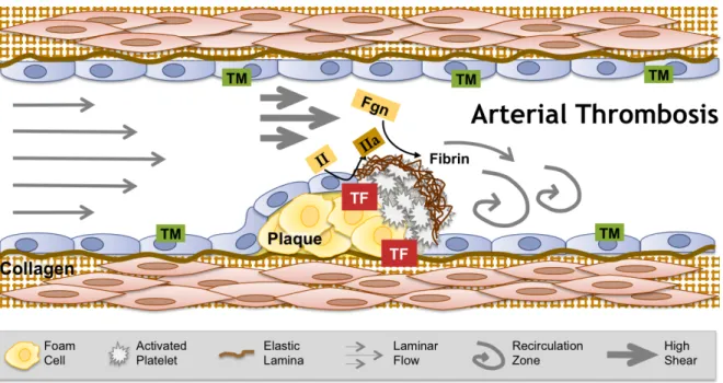 Figure 1.2.  Arterial thrombosis.  Interplay between abnormalities in blood components,  the vasculature, and blood flow contribute to the development of arterial thrombosis