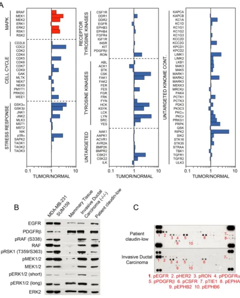 Figure 3.3 RAF-MEK-ERK pathway activation in TNBC.  A) RAF-MEK-ERK pathway  activated in patient TNBC tumors