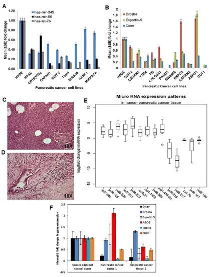 Figure 3: Expression patterns of miRNAs and components of the biosynthetic machinery in human PC tissues and cell lines