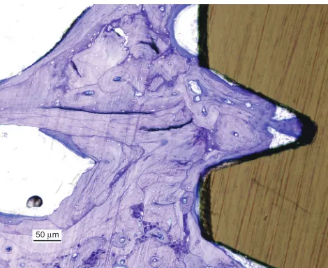 Figure 6 histological section of the bone to implant interface, stained with toluidine blue.