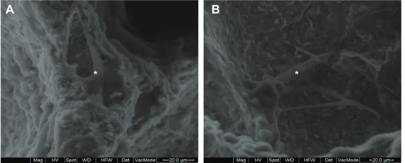 Figure 7 Scanning electron microscopy images of surface morphology of (A) nanofluorapatite (n-FA)/polyamide 12 (PA12) composite with 40 wt% n-FA and (b) PA12.