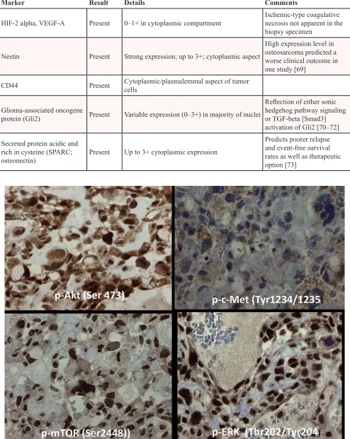 Figure 2: Immunohistochemistry based morphoproteomic studies of osteosarcoma Patient #1