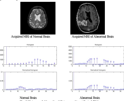 Fig. 3 Histogram & Normalized Histogram of input Brain MRI Image 