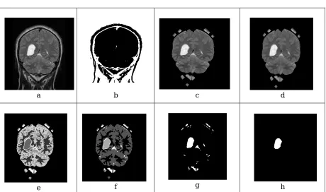 Fig. 5 (a) First original image MRI 1; (b) Binary image; (c) Image after morphological operation; (d) Final image after enhancement; (e) K-means cluster 1; (f) K-means cluster 2; (g) K-means cluster 3; (h) Tumor after segmentation 