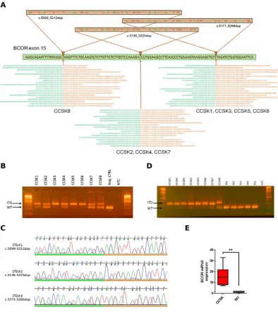 Figure 1: BCOR ITD detection by whole transcriptome sequencing. A.identified. Through three different ITD events in exon 15 of BCOR