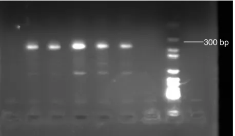 Figure 5 agarose gel electrophoresis of genomic DNa obtained from fresh blood.Notes: Briefly, various fresh blood samples were collected and genomic DNa was extracted by the magnetic microbead method