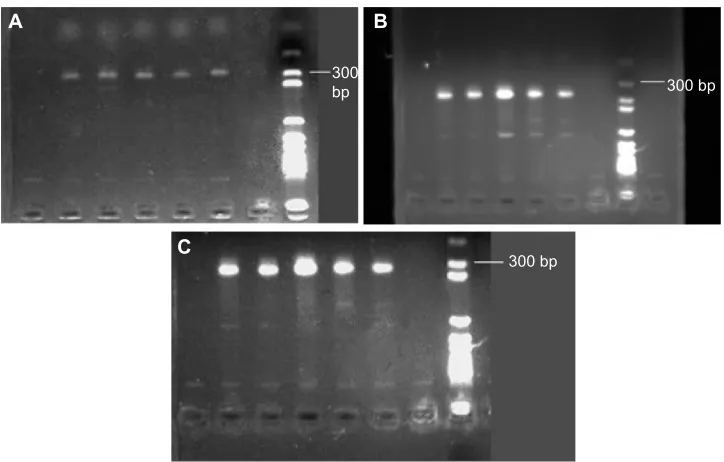 Figure 8 Pcr results for genomic DNa extracted from dried blood. (A) 50 µl, (B) 100 µl, and (C) 200 µl.Notes: Various dried blood samples were collected and genomic DNa was extracted by the magnetic microbead method