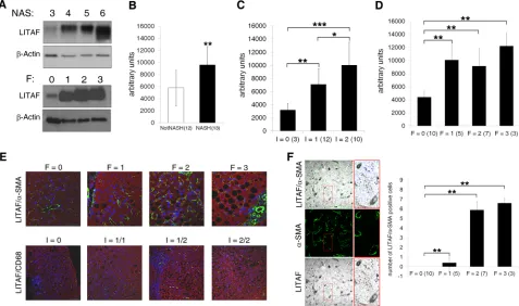 Figure 1: Hepatic LITAF expression increases in NAFLD children correlating with histological traits of hepatic inflammation and fibrosis