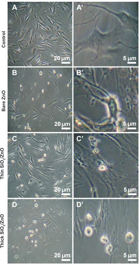 Figure 5 Morphology of hDFn cells exposed to NPs at 48 hours.Notes: Normal (20 µm) and magnified views (5 µm) of (A, A’) control cells, (b, b’) bare ZnO NP-exposed cells, (c, c’) thin siO2/ZnO NP-exposed cells, and (D, D’) thick siO2/ZnO NP-exposed cells, respectively.Abbreviations: HDFn, human dermal fibroblast neonatal; ZnO NPs, zinc oxide nanoparticles; thin siO2/ZnO, ZnO coated with a thin layer of SiO2; thick siO2/ZnO, ZnO densely coated with SiO.