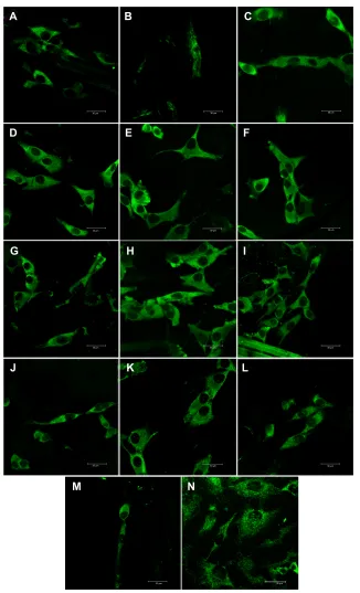 Figure 8 Immunofluorescence staining of talin in MG-63 cells cultured on a pure composite “0” (A), composites with 2–25 vol% nano-ha (ie, N2 [B], N5 [C], N10 [D], N15 [E], N20 [F], and N25 [G]), and composites with 2–25 vol% micro-ha (ie, M2 [H], M5 [I], M10 [J], M15 [K], M20 [L], and M25 [M]), and on polystyrene (N).Notes: leica sP2 confocal microscope (leica Microsystems, Wetzlar, germany), obj ×20, zoom ×4, water immersion; scale bar =30 µm.Abbreviation: ha, hydroxyapatite.