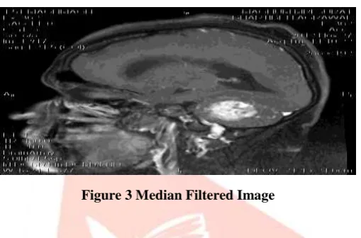 Figure 3 Median Filtered Image 