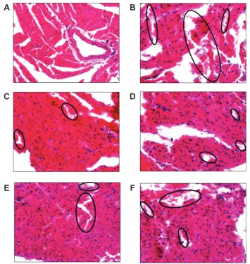 Figure 6 Typical images of pathological classification of myocardium injury of different DOX formulations: (A) Ns; (B) DOX solution; (C) Nh4eDTa-l (low-dose);  D) Nh4eDTa-l (medium-dose); (E) Nh4eDTa-l (high-dose); and (F) (Nh4)2sO4-l.Notes: Photographs we
