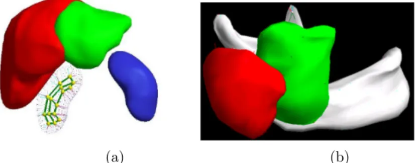 Figure 1. Examples of 3-dimensional medical images (obtained by MIDAG at UNC Chapel Hill) of a collection of  physiologi-cal objects which can be modeled by a multi-region  configura-tion