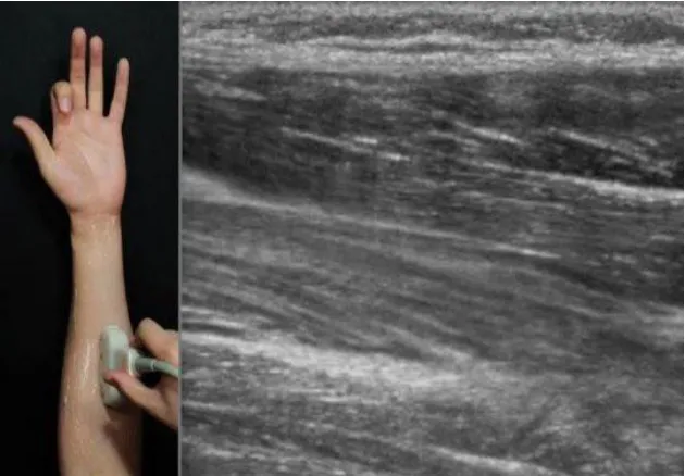Fig. 3: This is ultrasonic imaging of the forearm. 