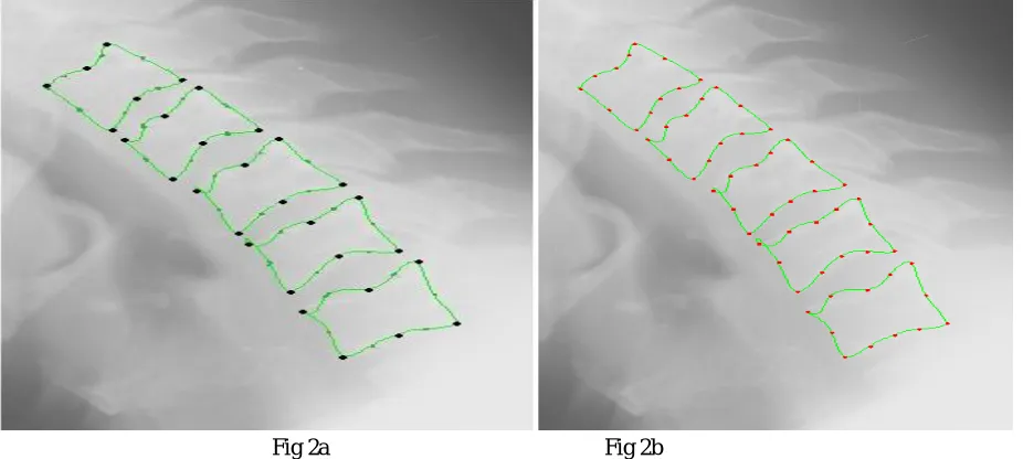 Fig 2a                                                  Fig 2b Fig 2a, 2b: Black dots indicate the morphometric points and red dots are the landmark points