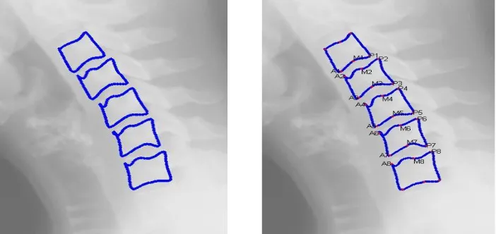 Fig.6 a, Initial positioning of AAM model.   Fig.6 b, c, d   result of image scaling. 