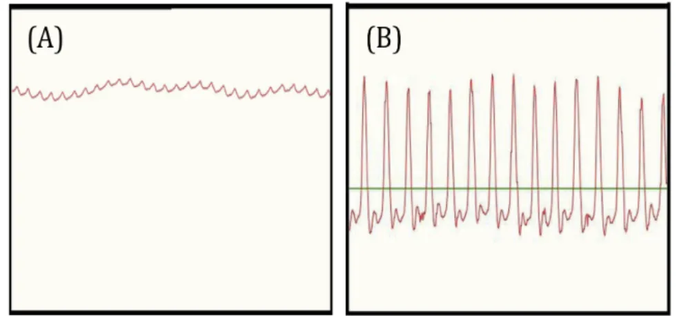 Figure 3.2. Signal comes from the Pulse Sensor before (A) and after (B) using the filter chip