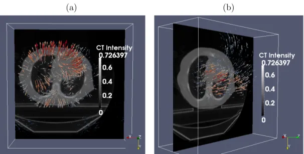 Figure 5.4.2: The (a) first and (b) second principal deformation basis functions analyzed from a lung RCCT dataset