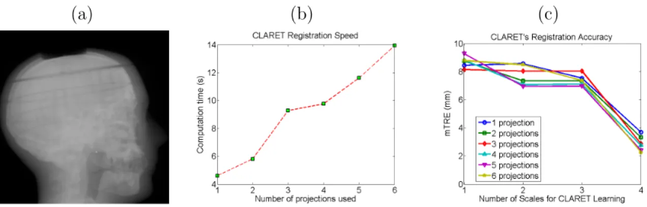 Figure 5.5.3: (a) One of the test NST projections of a head phantom. (b) Time plots and (c) error plots of CLARET’s registrations on a real head-and-neck phantom dataset.