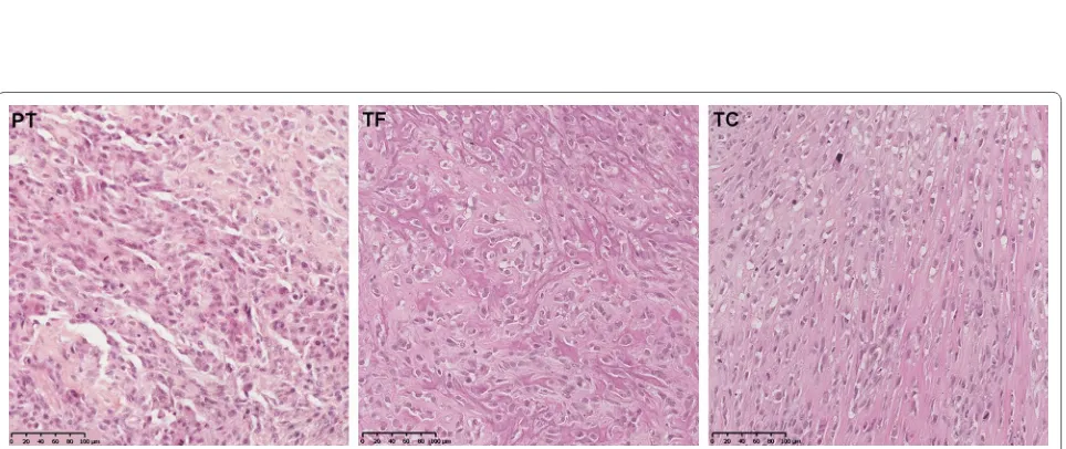Fig. 3 Histological comparison of the osteosarcoma parental tumor (PT) (left) with the PDX models derived from a tumor fragment (TF) (middle) and from the AT2015 tumor cells (TC) (right) (OM × 20)