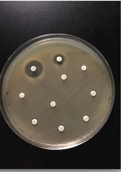FIG 1 CTX-M-15 ESBL of this MBL-producing C. freundii isolate could be detected only with the ATM plusCA test