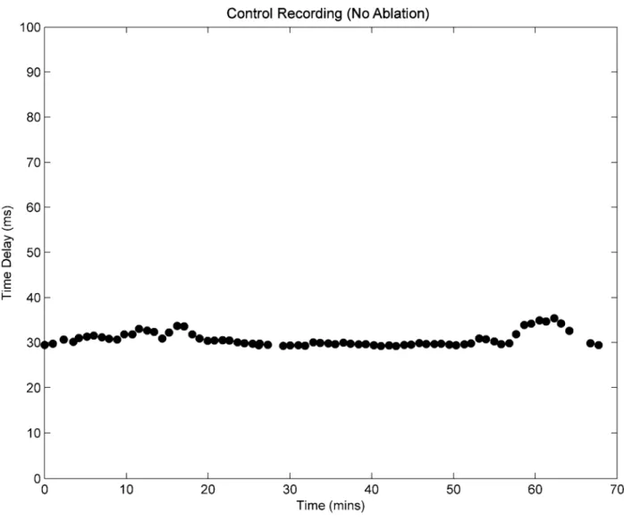 Figure 4.2  Control recording of time delay over a 1-hour period. Filled circles represent individual recorded  values for time delay